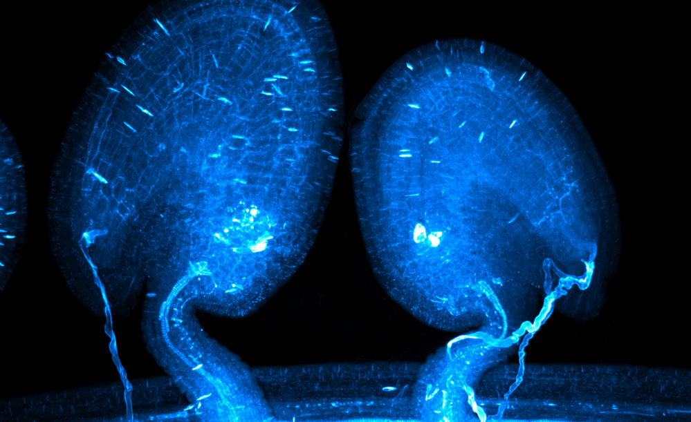 Two developing seeds receiving single (left) or double (right) pollen tube(s) in Arabidopsis thaliana