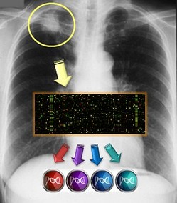 Patients at high risk of a relapse of lung cancer after surgical removal of their tumor can be accurately identified from a gene expression signature in affected tissue.