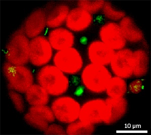Fig. 1: Confocal image of a protoplast. Auto-fluorescing chloroplasts are in red, and multiwalled carbon nanotubes are visible in green.