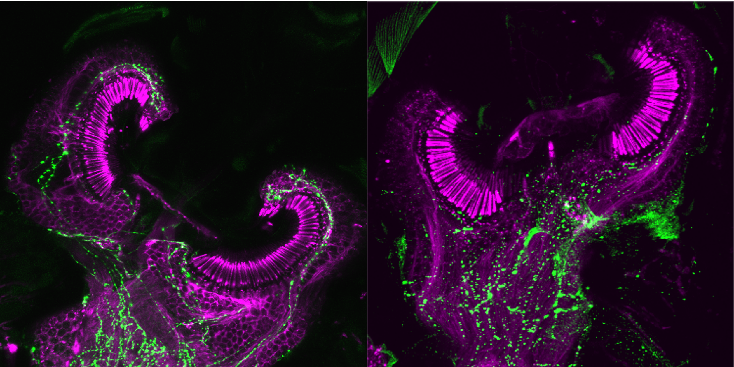 Sections of male (left) and female (right) mosquito ears showing extensive expression of the major neurotransmitter serotonin in green.
(Credit: Yifeng Xu)