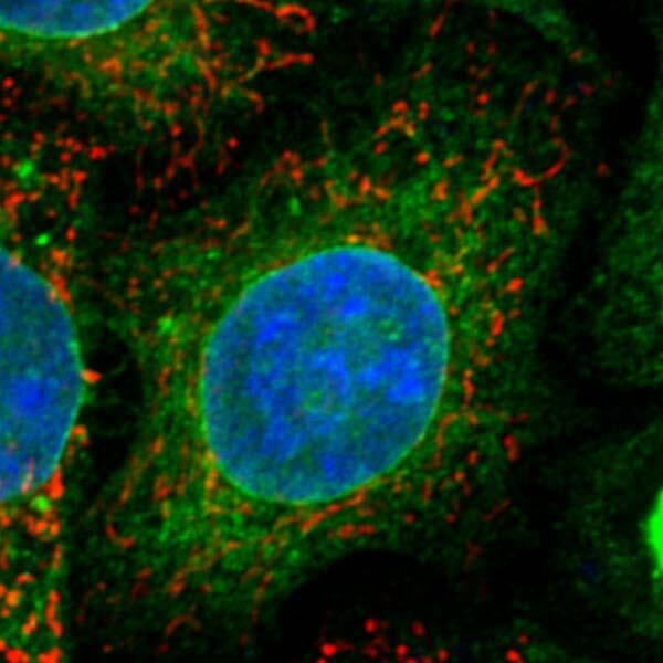 Researchers have discovered a receptor, sigma-1 receptor (green), and a protein, ATAD3A (red),
that are associated with Amyotrophic Lateral Sclerosis (ALS), also known as Lou Gehrig’s disease.
(Image credit: Yamanaka Laboratory)
