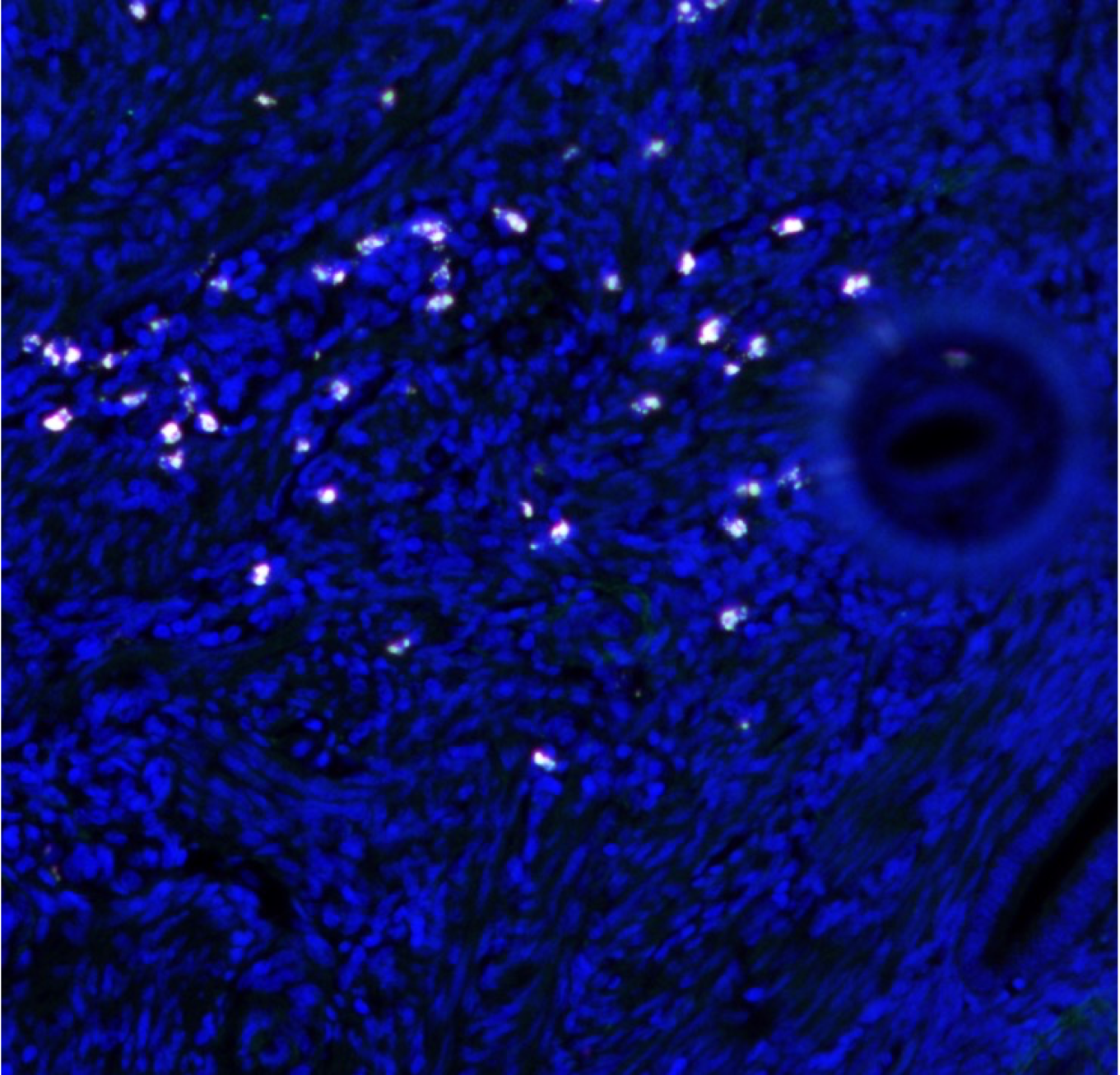 Fusobacterium (white dots) is highly expressed near the uterus (endometrium) of endometriosis patients.
(Credit: Professor Yutaka Kondo)