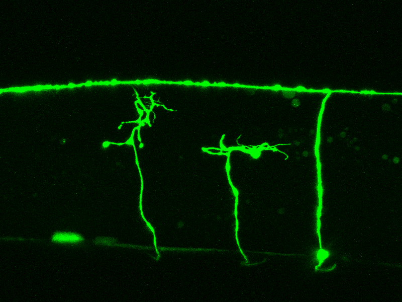 Caption: Regenerating neurons in C. elegans