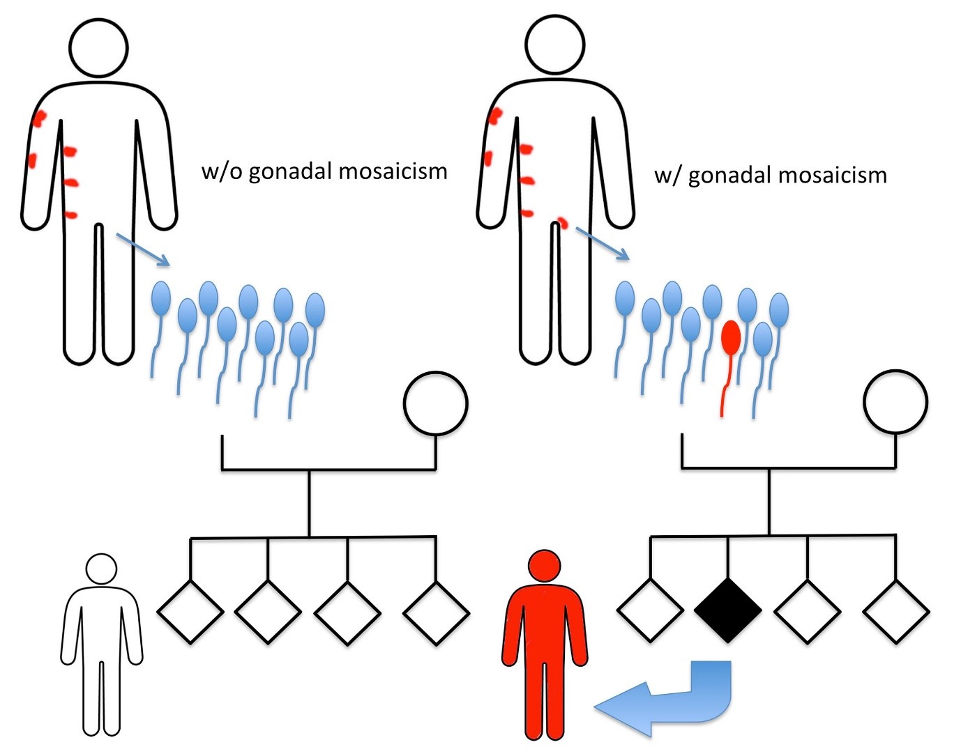 Caption: Epidermolytic nevus (EN) is visible as patches of thickened skin over small areas of the body. Mutations in genes encoding the skin proteins keratin 1 or keratin 10 are responsible for EN, but these mutations only occur in some cell populations of the body, including those of skin lesions, so they are known as mosaic. When the causative mutation occurs in germ cells, it is known as gonadal mosaicism. Birthmarks are not usually inherited because sperm cell genes are rarely mutated. However, when inheritance does occur, the children develop skin symptoms identical to their affected parent but covering their entire body. @ Michihiro Kono