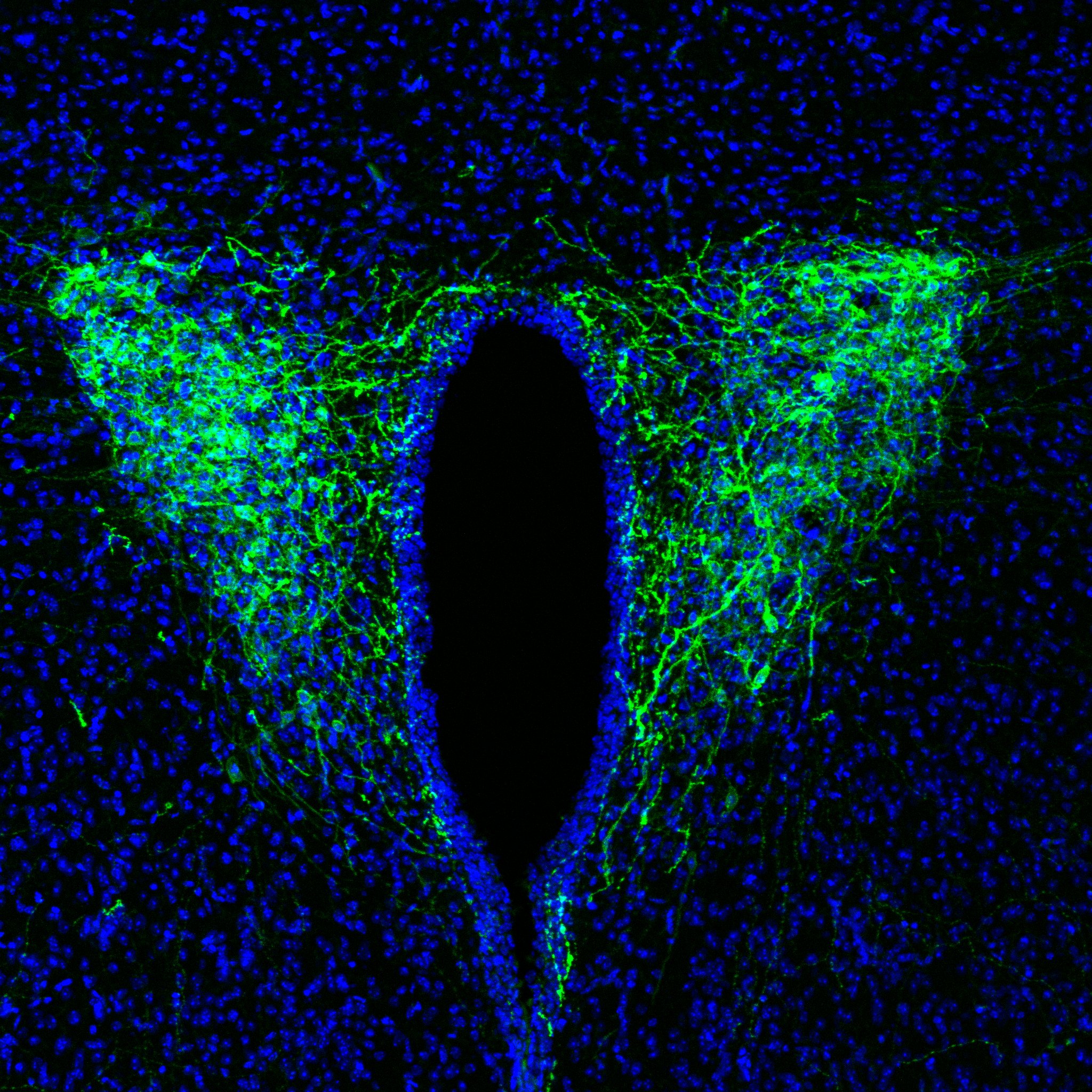 The optogenetic tool "Channelrhodopsin2" expresses CRF neurons in the paraventricular nucleus of the hypothalamus in mice. These neurons were found to be part of the neural pathway that is crucial for the circadian regulation of sleep and wakefulness. Overactivity of CRF neurons due to stress or disturbed circadian rhythm is likely to cause insomnia and other sleep disorders in humans. (Credit: Daisuke Ono)