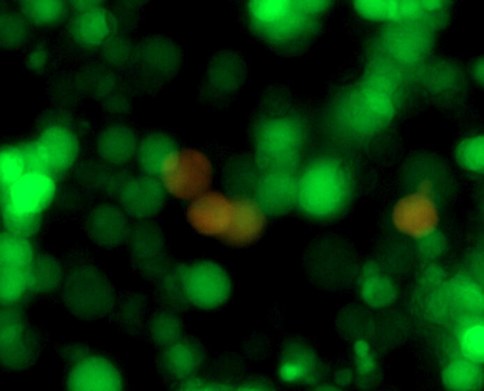 Cells infected with Epstein-Barr virus was labelled with green. A certain viral gene (red) was expressed in a small subset of infected cells, showing a heterogeneous population of virus infected cells.