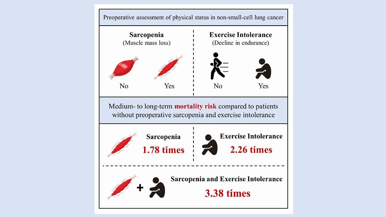 Age-related muscle loss and walking abilities predict outcomes after lung cancer surgery