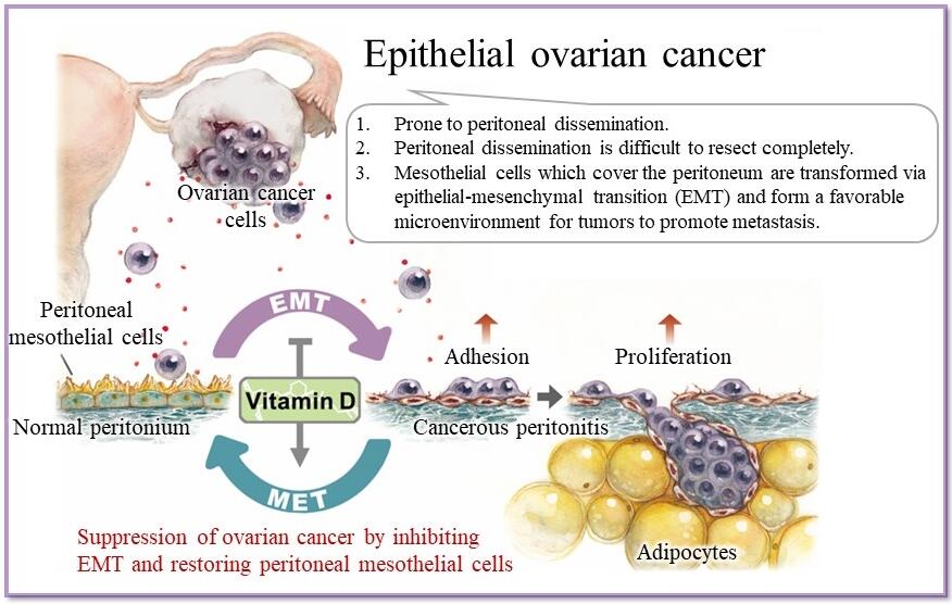 Vitamin D may restore the body’s natural barrier against ovarian cancer
