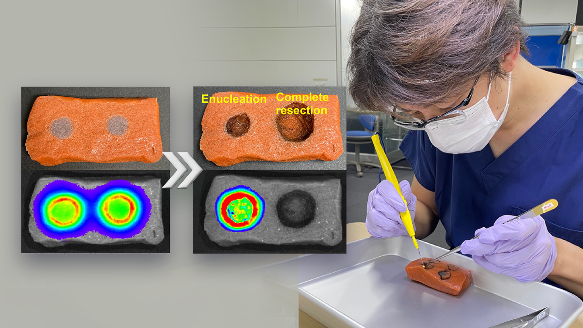 Researchers develop a new surgical training model for fluorescence-guided cancer surgery using the Japanese food konjac jelly