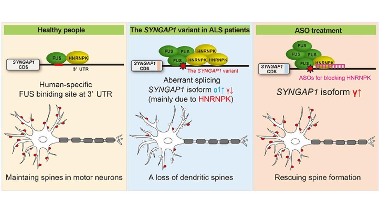Using human iPS cells, scientists identify the genetic variant causing ALS in some patients