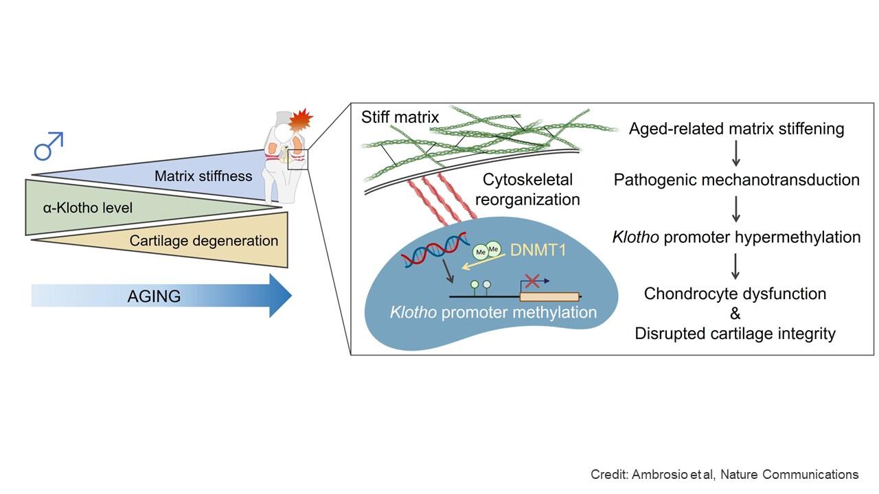 New Mechanism Uncovered Behind Osteoarthritis Could Inform New Treatments