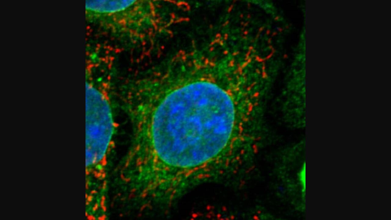 Targeting mitochondria and related protein suggest new therapeutic strategy for treating Lou Gehrig’s disease (ALS)