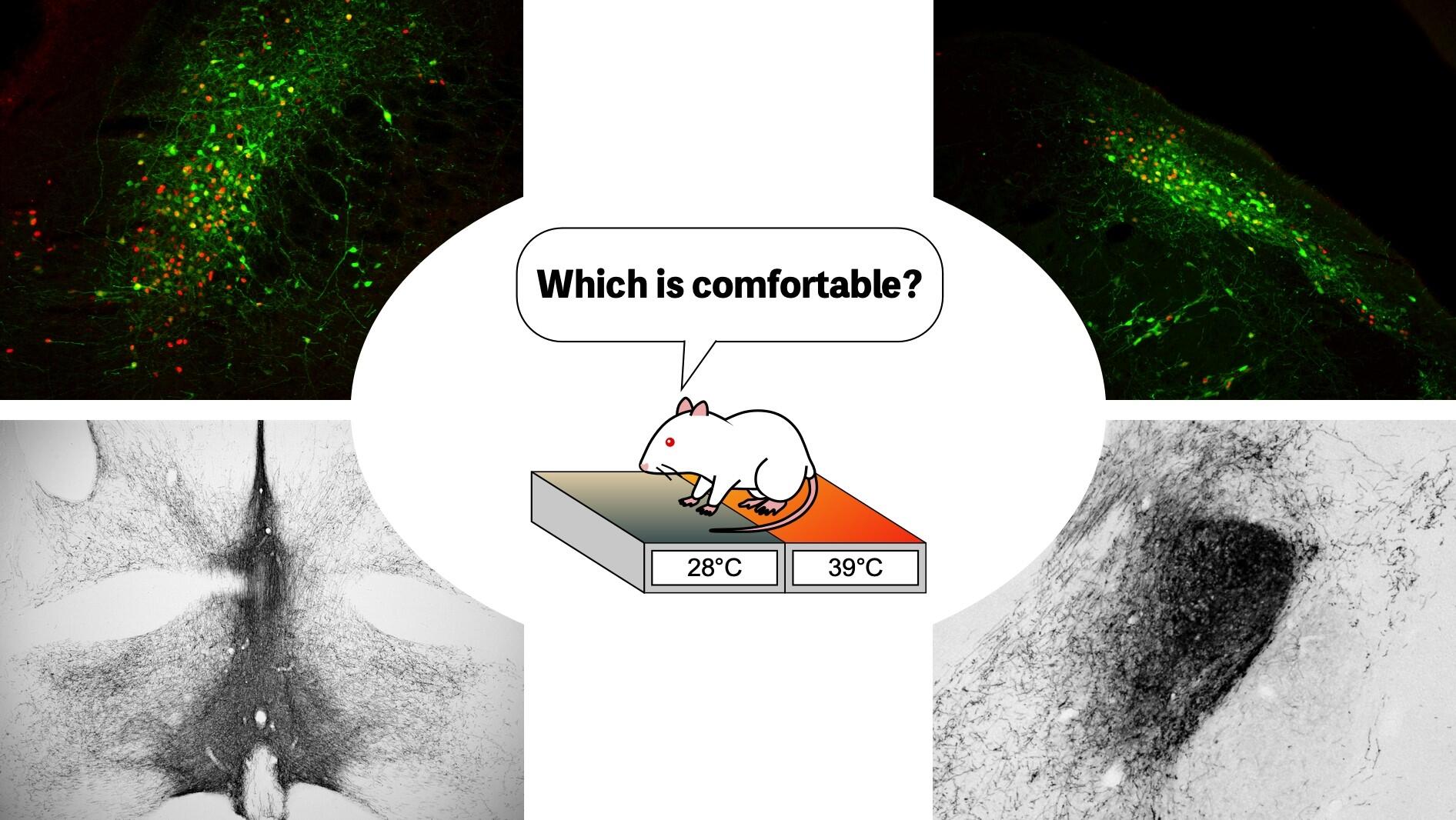 Understanding brain network connecting temperature sensation and emotion may help prevent heatstroke