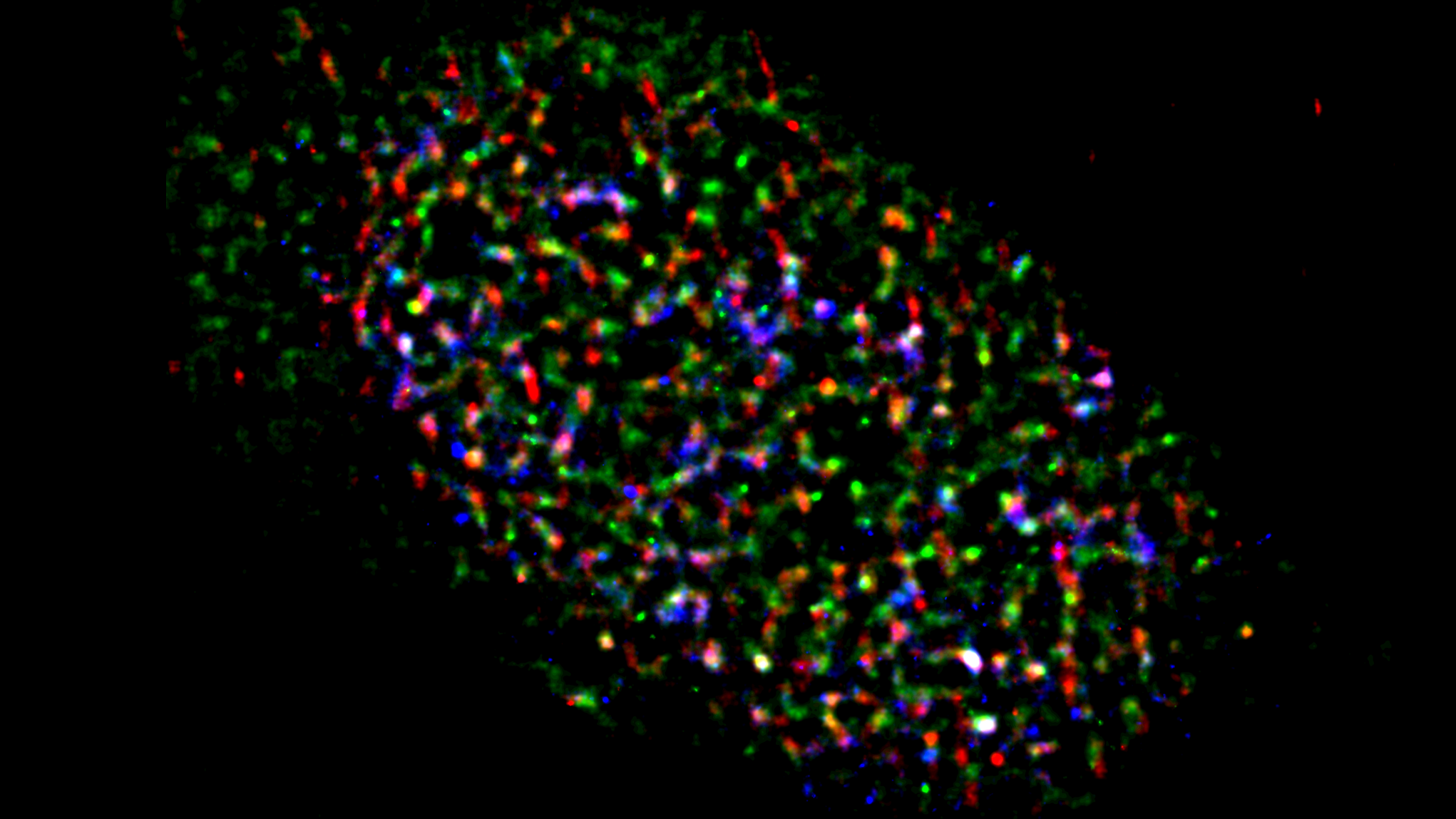 Brain tumor treatment by targeting TUG1, a gene that controls replication stress