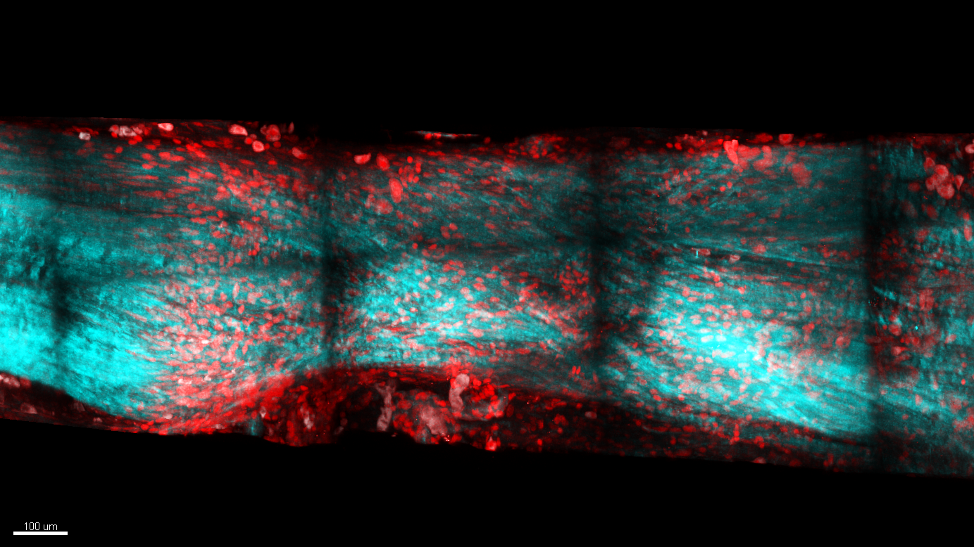 Understanding rapid tendon regeneration in newts may one day help human athletes