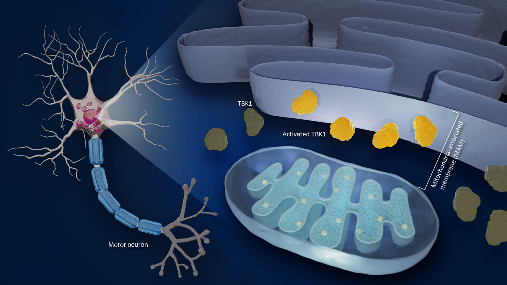 Progression of ALS linked to a membrane and an enzyme: mitochondria-endoplasmic reticulum disruption and loss of TBK1 activity