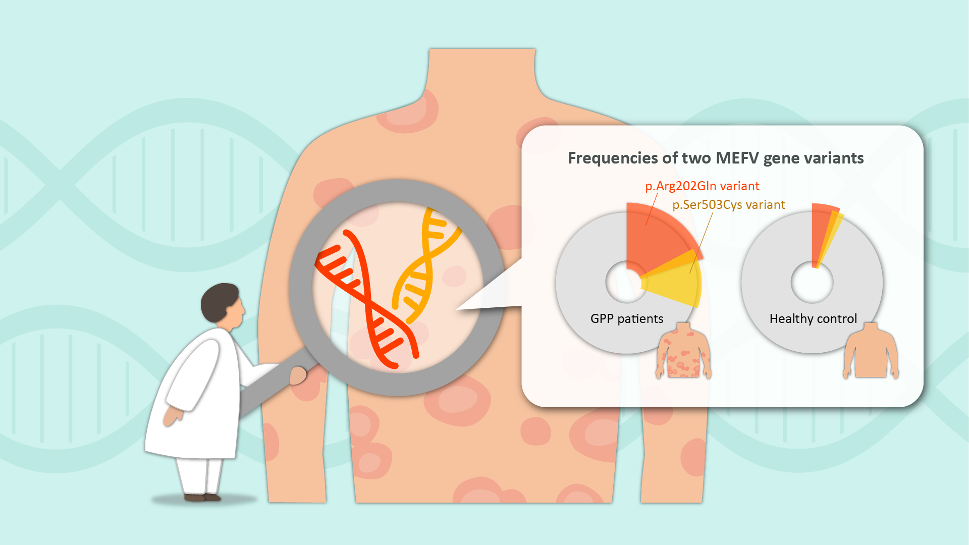 Missing disease-related gene identified in generalized pustular psoriasis