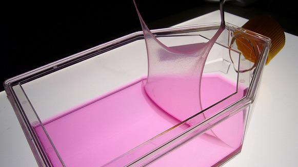 Treating rare skin diseases by transplanting healthy skin