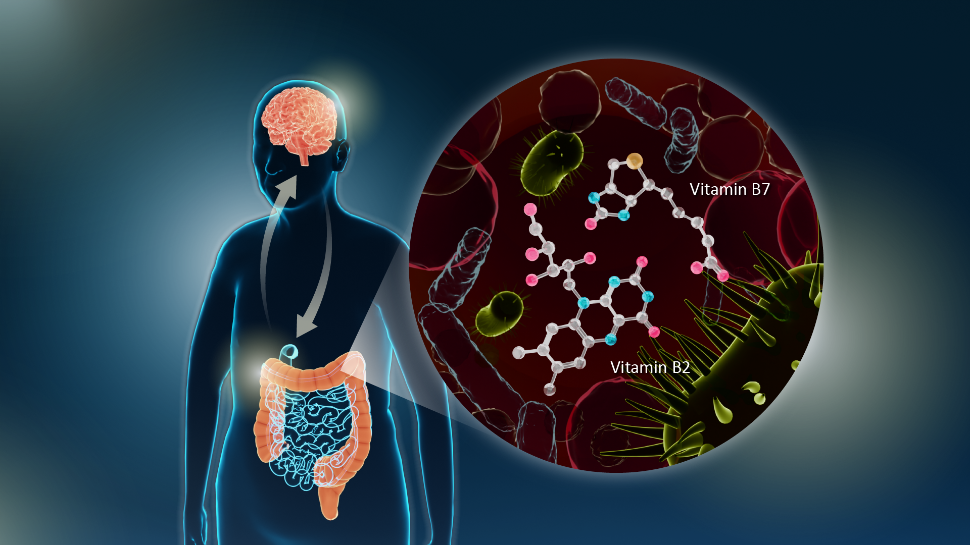 Treating the gut-brain connection with B vitamins to treat Parkinson’s Disease