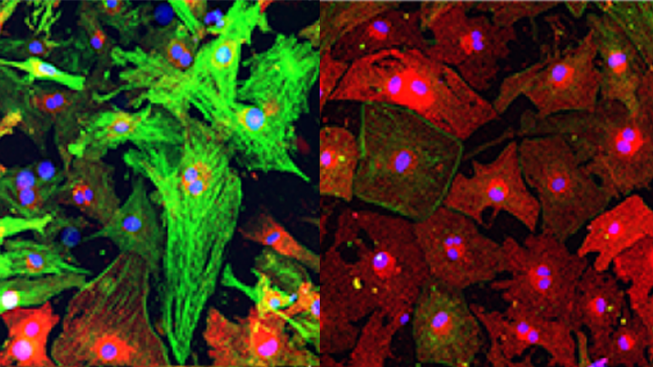 Researchers discover new target for treating heart failure: Protein kinase N