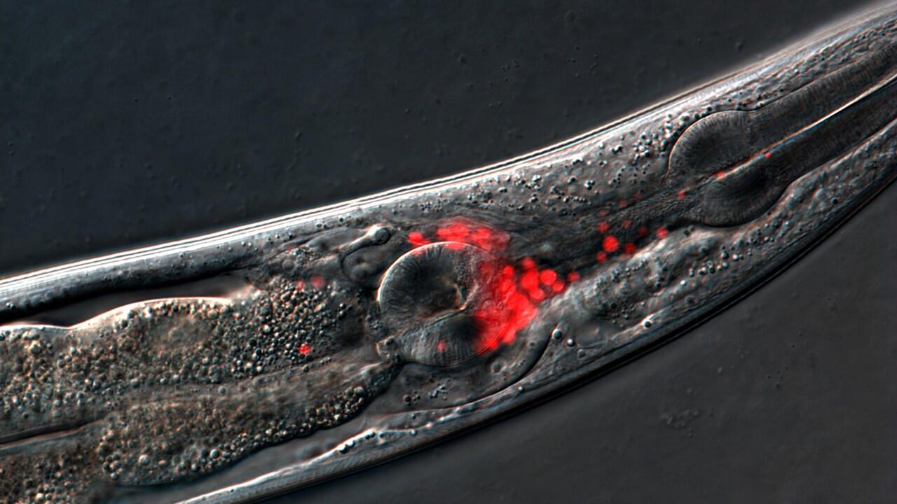 Worm study shows hyperactivated neurons cause aging-related behavioral decline