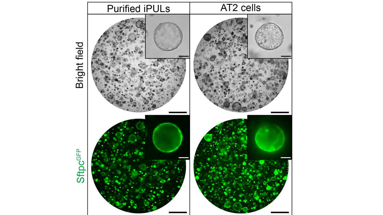 Researchers generate lung cells from mouse fibroblasts in just 7 to 10 days