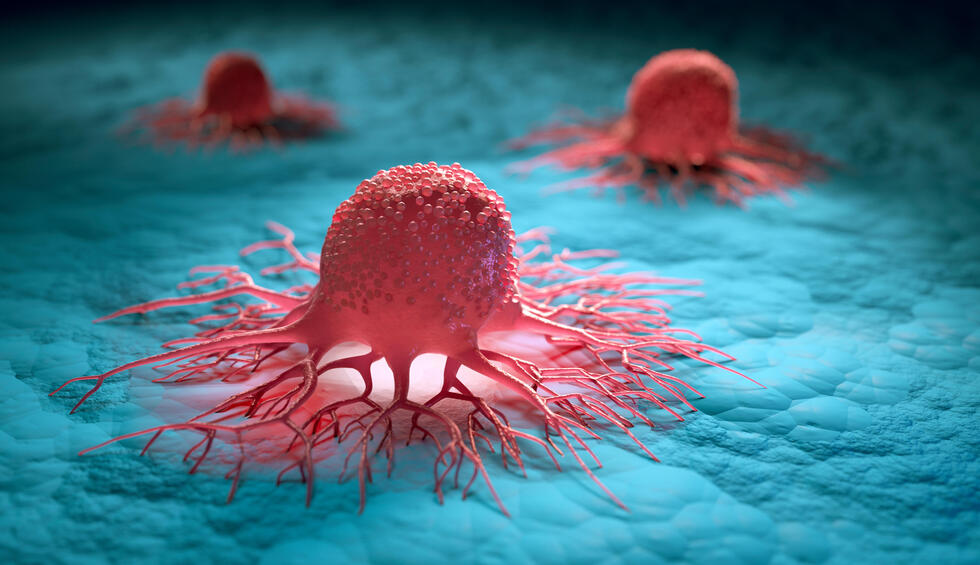 Tumor marker detects gastric cancer with nearly 90% accuracy