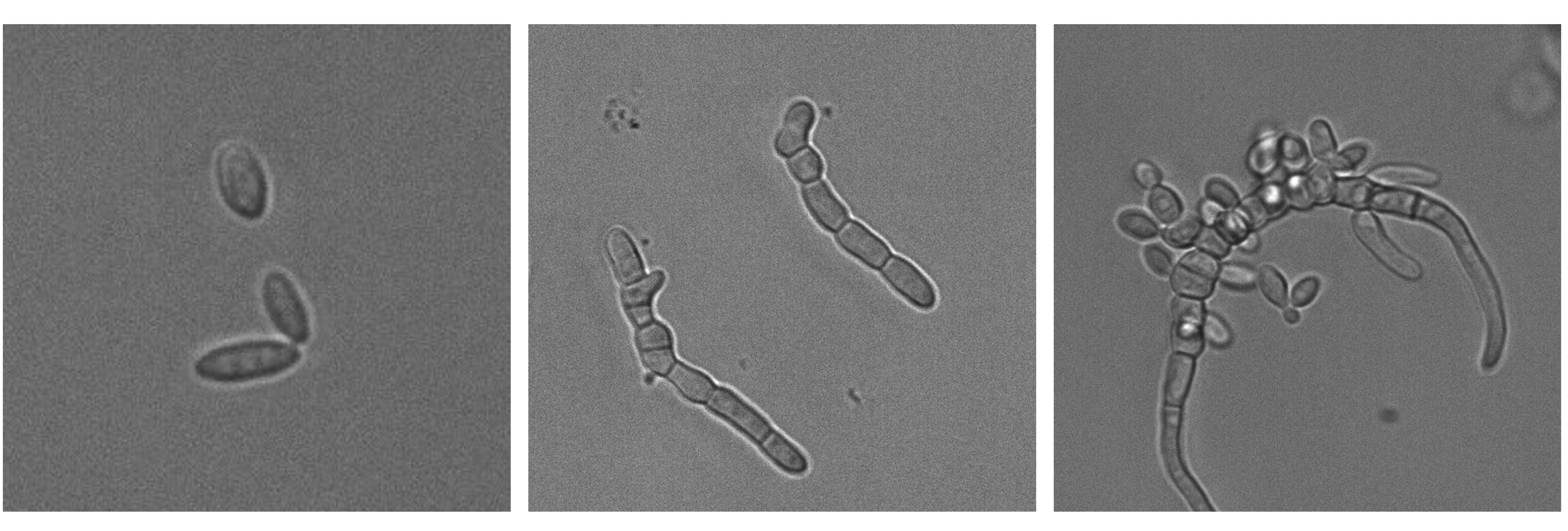 Nature study identifies a molecular switch that controls transitions between single-celled and multicellular forms 