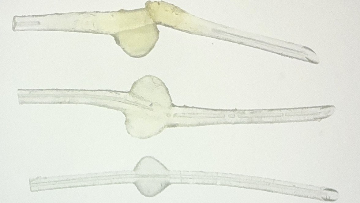 Common eye ointment can damage glaucoma implants, study warns