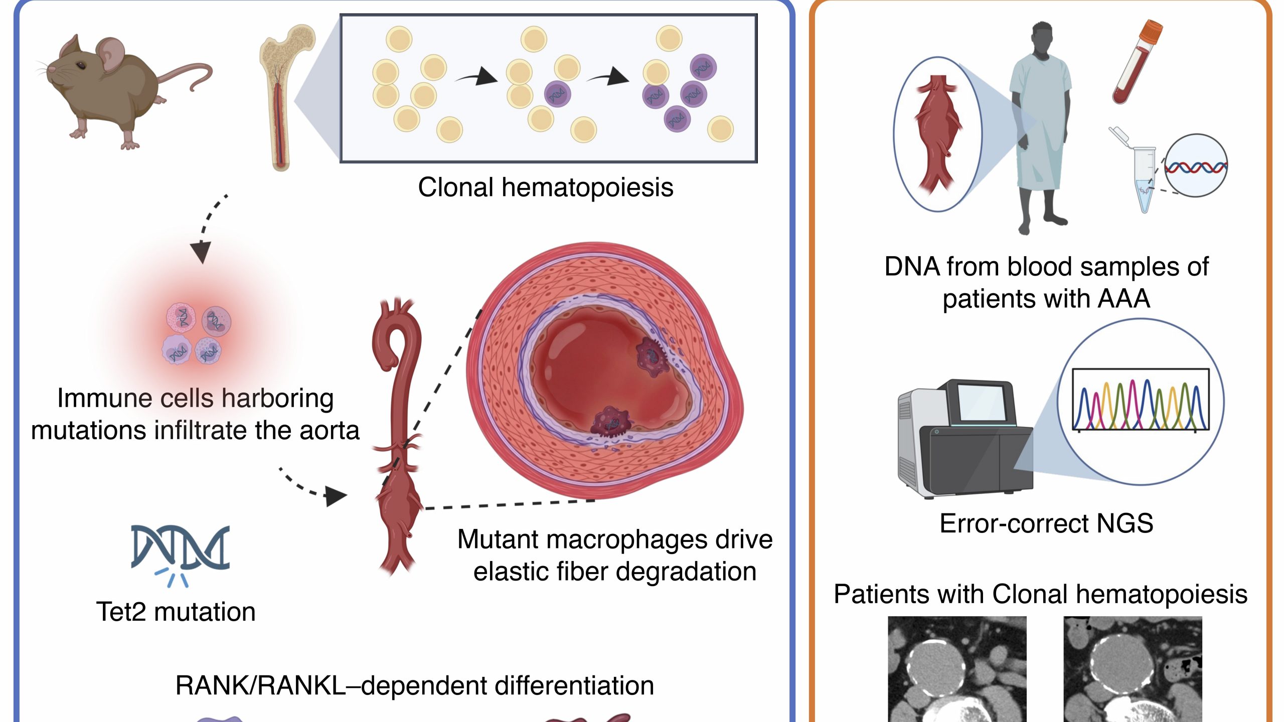 Study shows mechanisms of aortic aneurysm progression and potential drug therapies