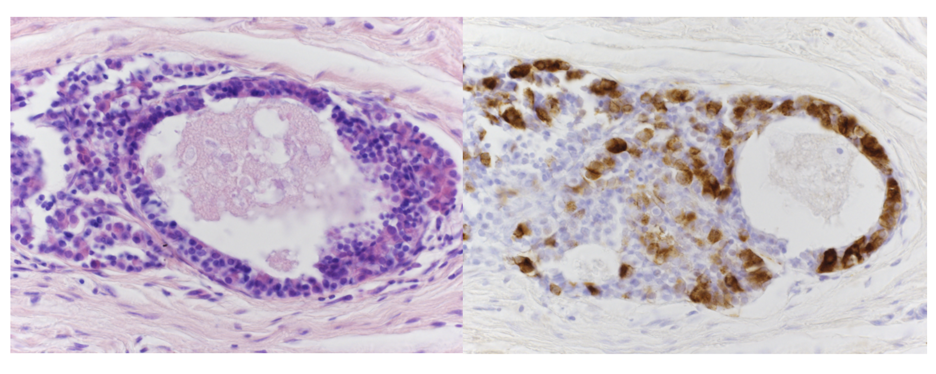 First successful primate transplant of human pituitary tissue restores cortisol