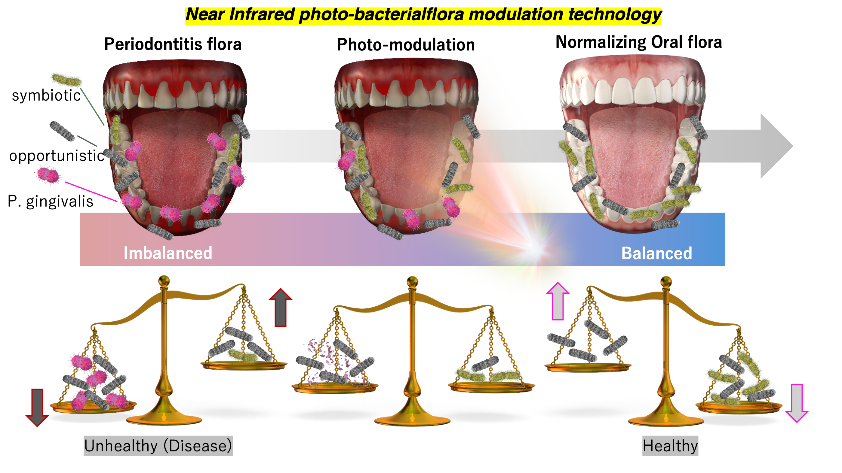 New therapy eliminates gum disease bacterium while preserving beneficial oral microbes