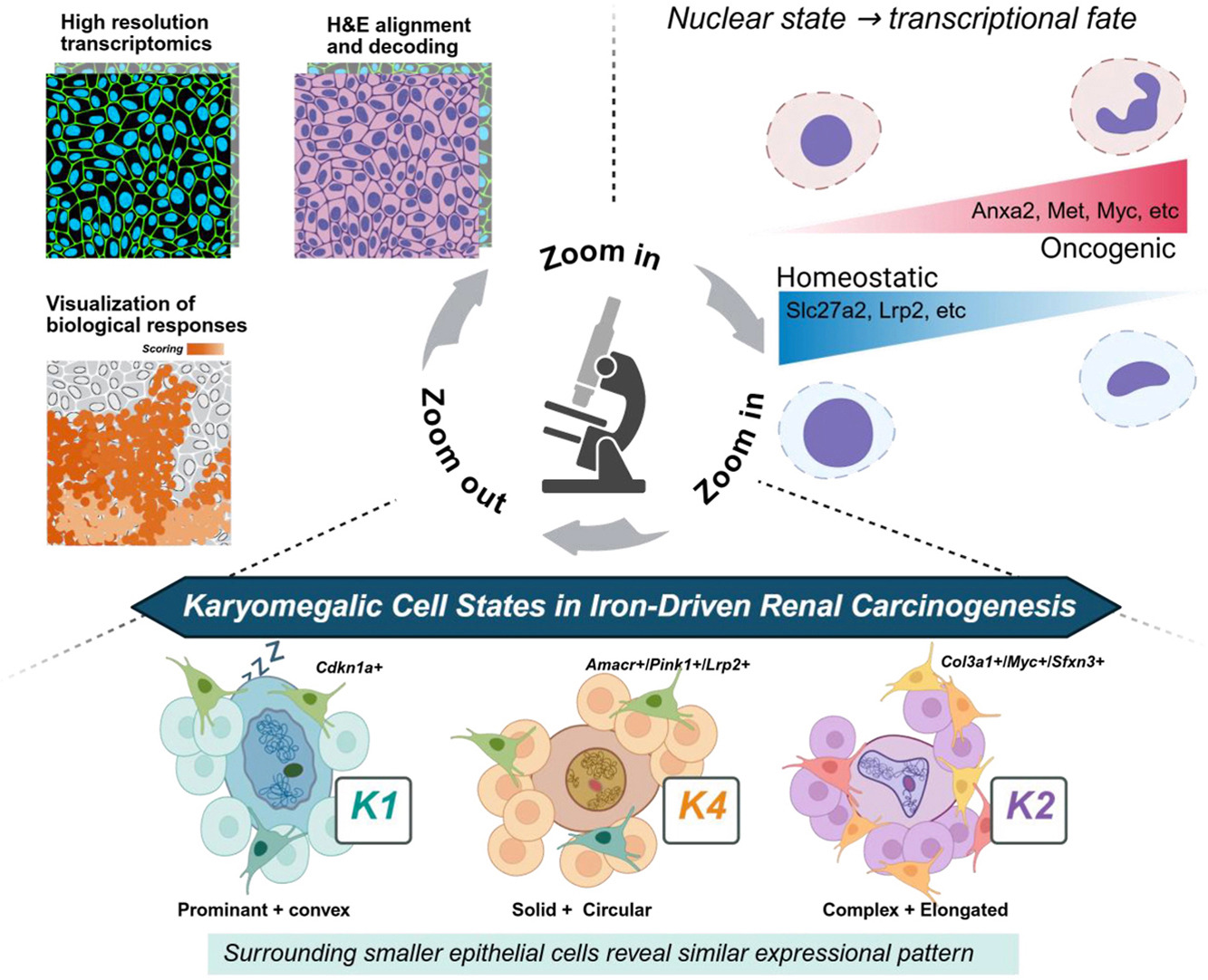 Giant-nucleus cells are key markers for early-stage cancer, study shows