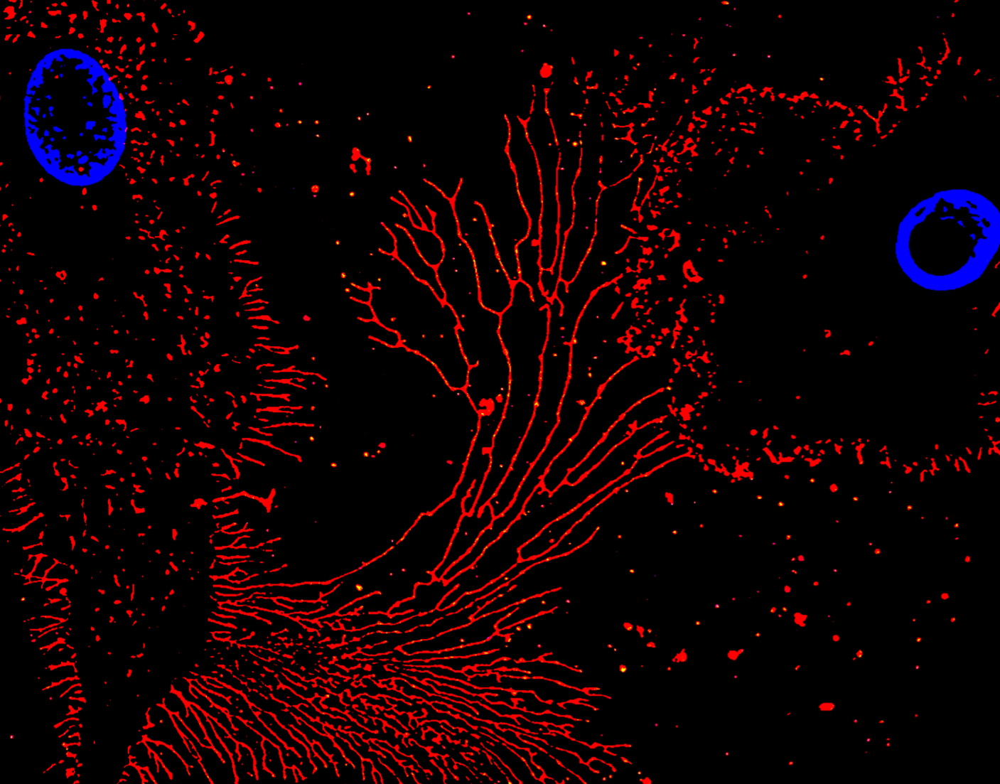 Shifting immune cells back toward cancer-fighting mode