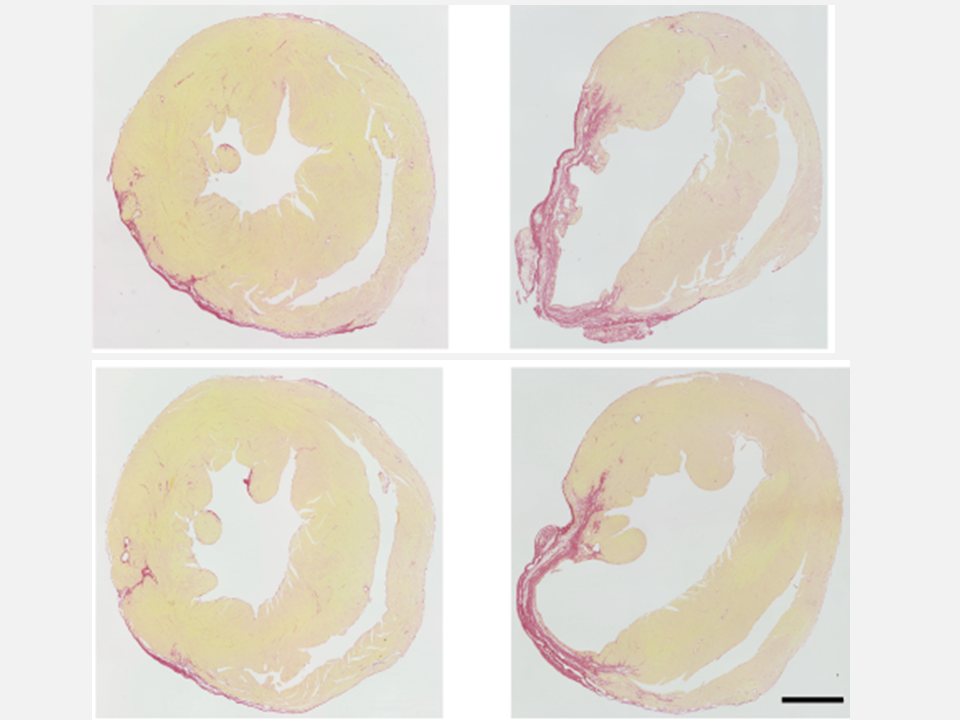 Blocking enzyme reduces heart failure risk after heart attack in mice