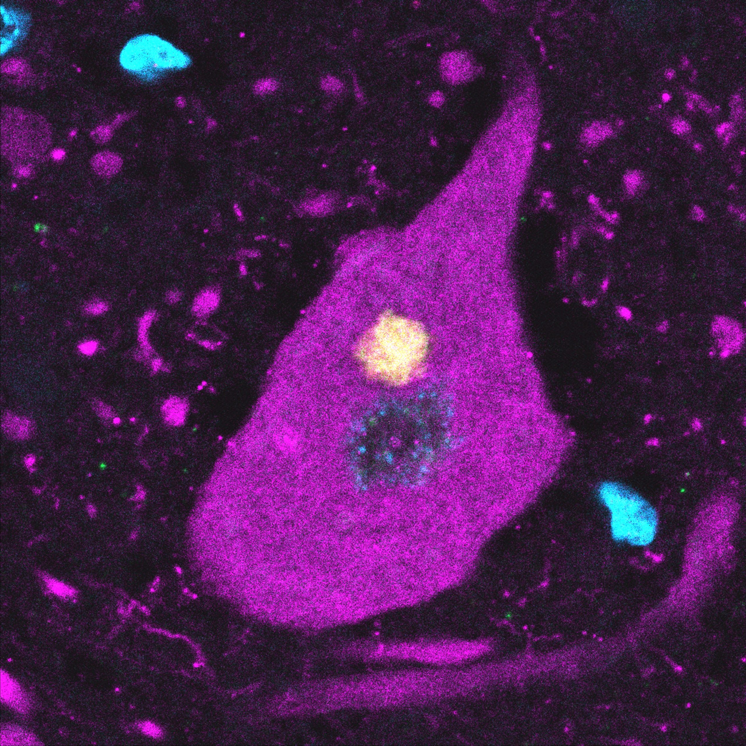 A new path(way) for ALS research opens